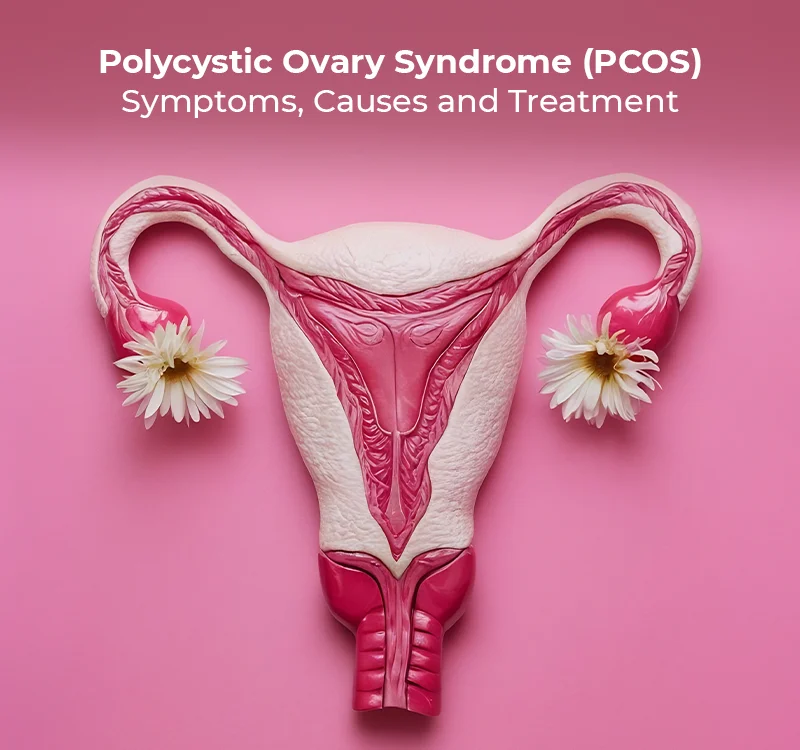 PCOS